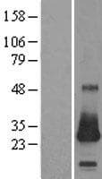 CSRP2 Protein (Over-Expression Lysate Myc-DDK (Flag))