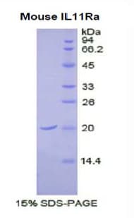 Mouse IL11RA Protein (Recombinant His)