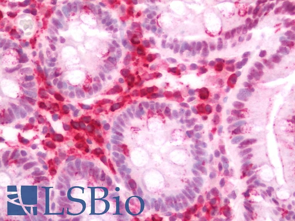 IHC-plus™ NEK2 Antibody (aa396-426)
