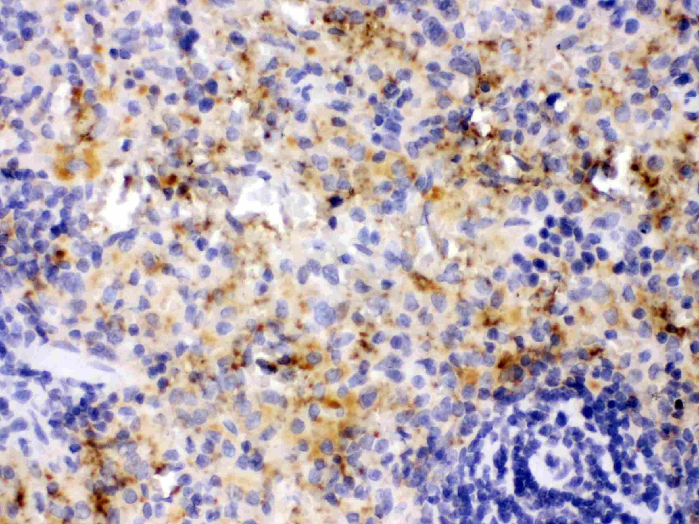 CXCL4 / PF4 Antibody
