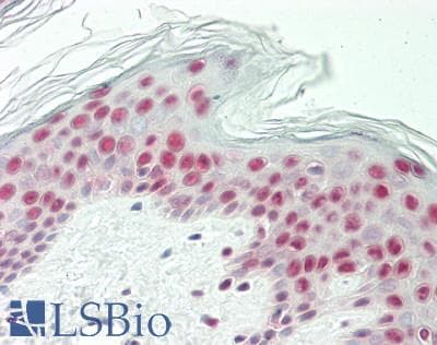 IHC-plus™ GLI / GLI1 Antibody (aa755-1106, clone 4E2)