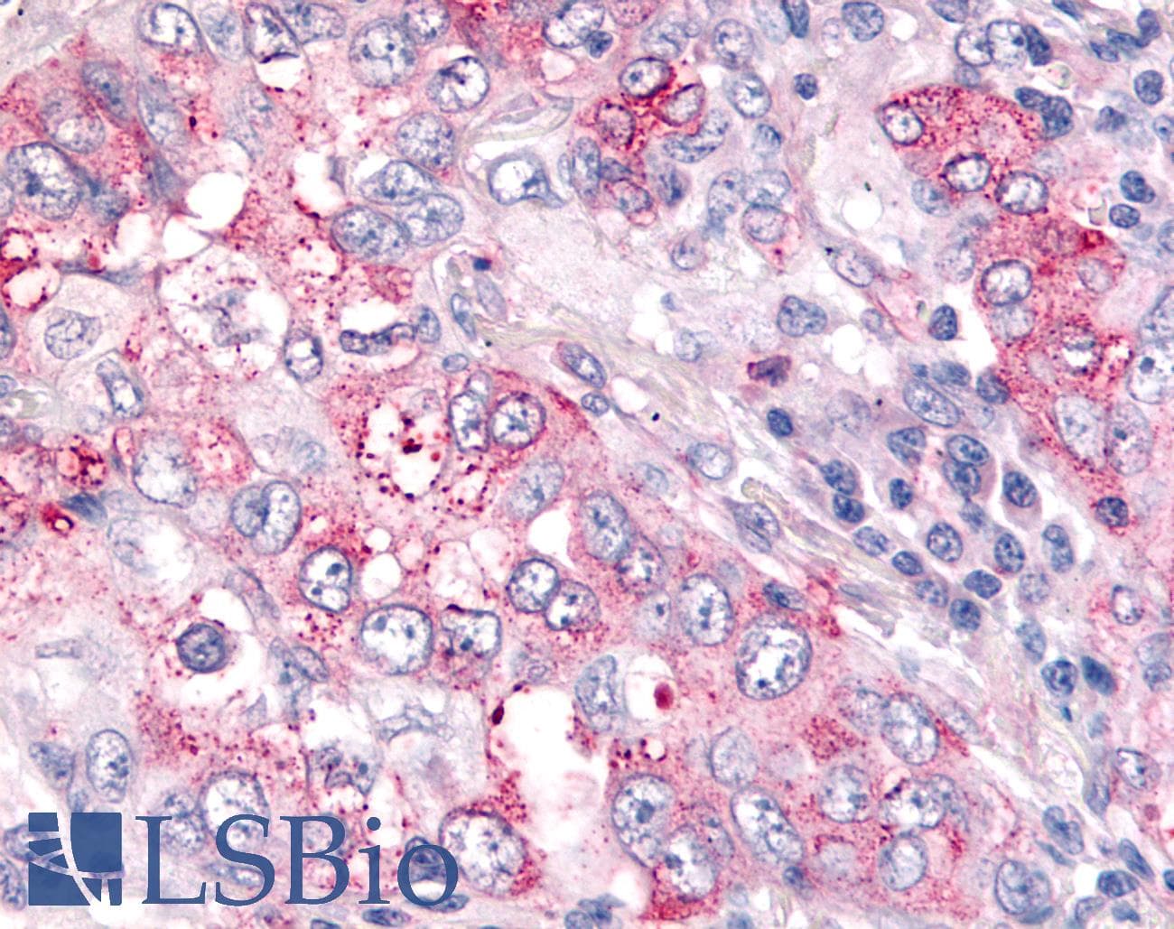 IHC-plus™ Polyclonal Rabbit anti-Human USP4 Antibody (N-Terminus, IHC, WB)