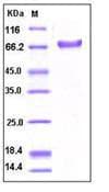 Human IL2RA / CD25 Protein (Recombinant His,C-terminus)