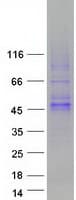 Human WNT16 Protein (Recombinant Myc-DDK (Flag))