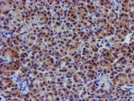 VCAM1 / CD106 Antibody (clone OTI4E8)