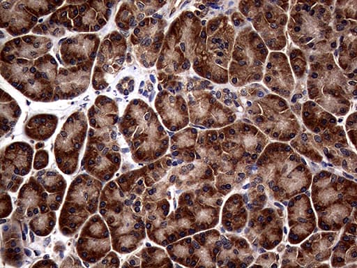 Monoclonal Mouse anti-Human ATG16L1 / ATG16L Antibody (clone OTI5A2, Carrier-free, aa1-277, IHC, WB)