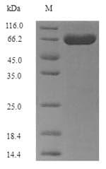Gardnerella vaginalis Modification Methylase AccI Protein (Recombinant 6His, N-terminus)