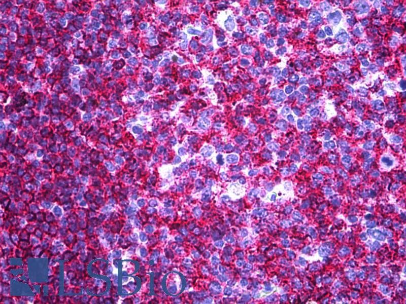 IHC-plus™ Monoclonal Mouse anti-Human B cell Antibody (clone MB1, Concentrated, IHC)