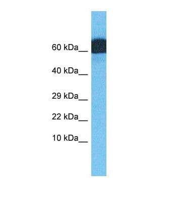 ZNF746 / PARIS Antibody (N-Terminus)