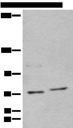 NCAPH / CAP-H Antibody