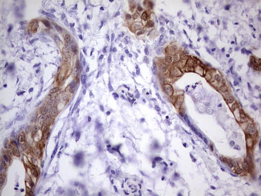 S100A6 / Calcyclin Antibody (clone OTI5A10)