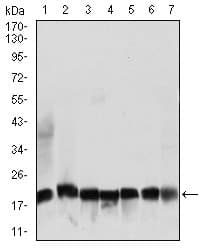 Monoclonal Mouse anti-Human RPL18A Antibody (clone 6G6G10, aa50-176, IHC, IF, WB)