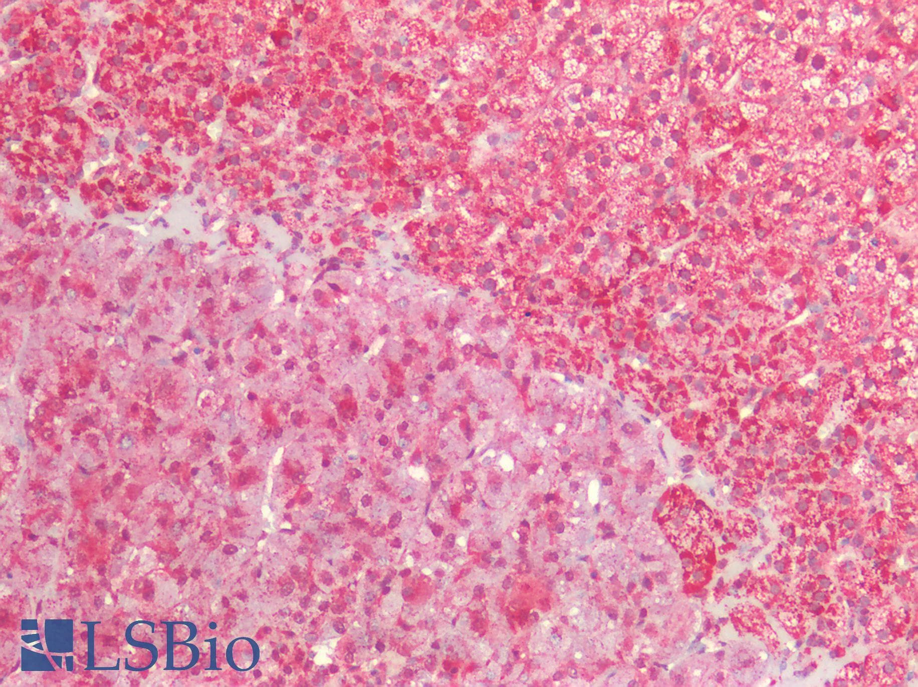 PathPlus™ Polyclonal Rabbit anti-Human HSPD1 / HSP60 Antibody (IHC, WB)