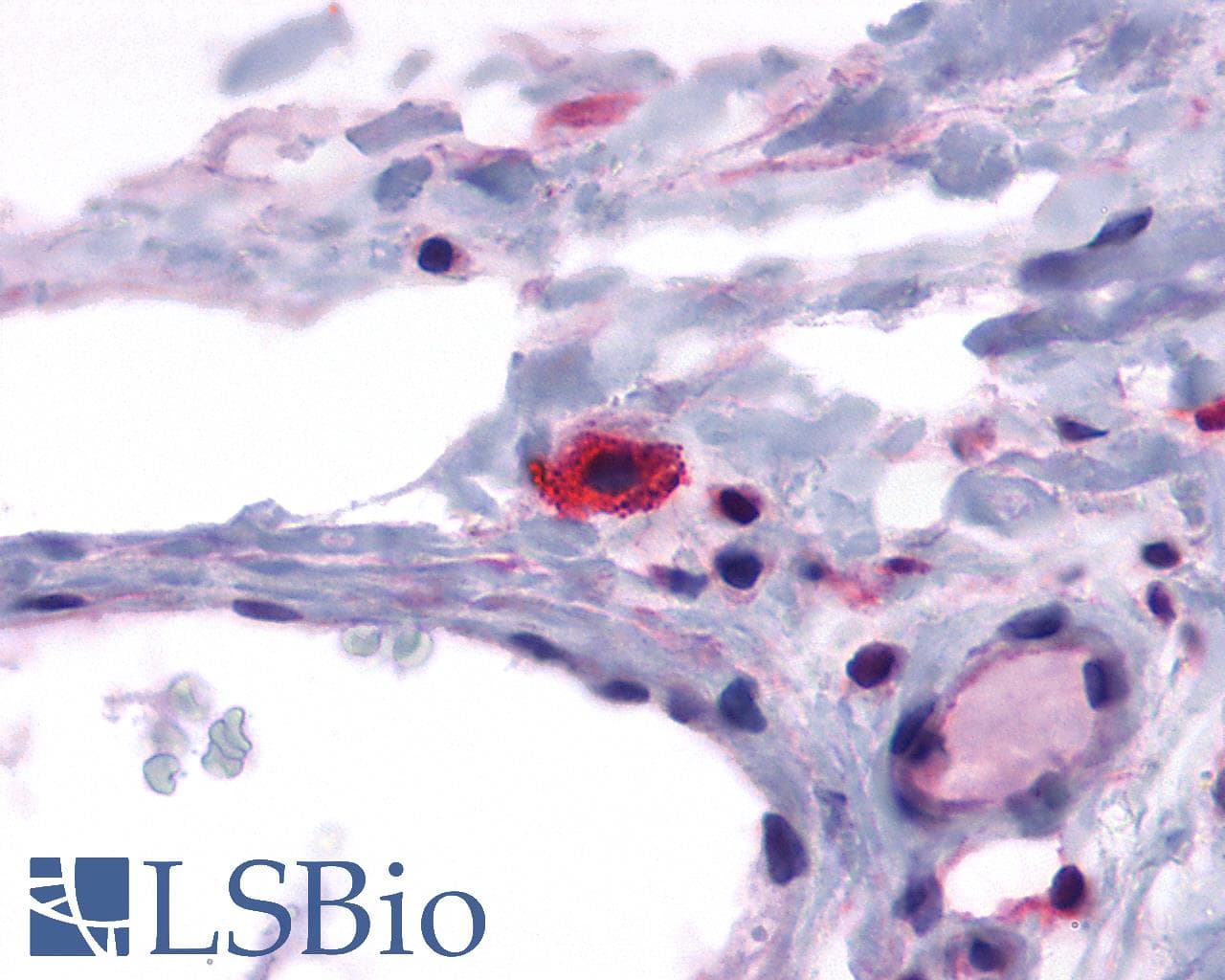 IHC-plus™ GPR44 / CRTH2 Antibody (C-Terminus)