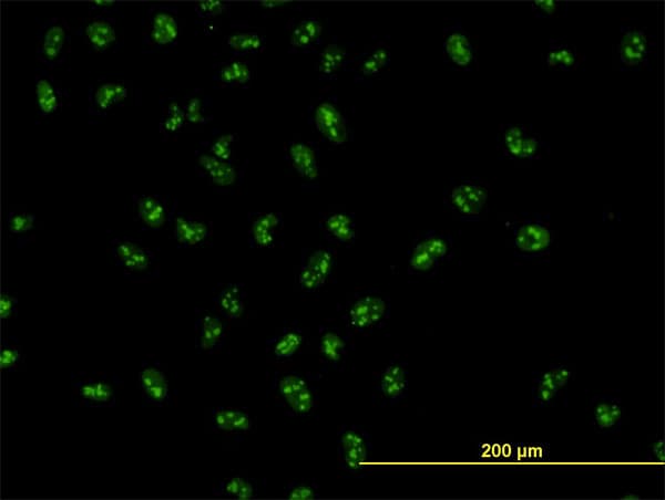 UBTF / UBF Antibody (clone 6B6)