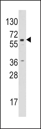 CYP19 / Aromatase Antibody (aa453-485)