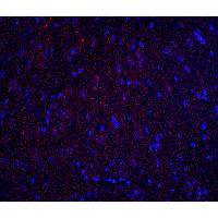 Polyclonal Rabbit anti-Human HOOK3 Antibody (IHC, IF, WB)