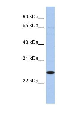 PEX11B Antibody (N-Terminus)