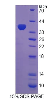 Rat STAP1 / BRDG1 Protein (Recombinant His)