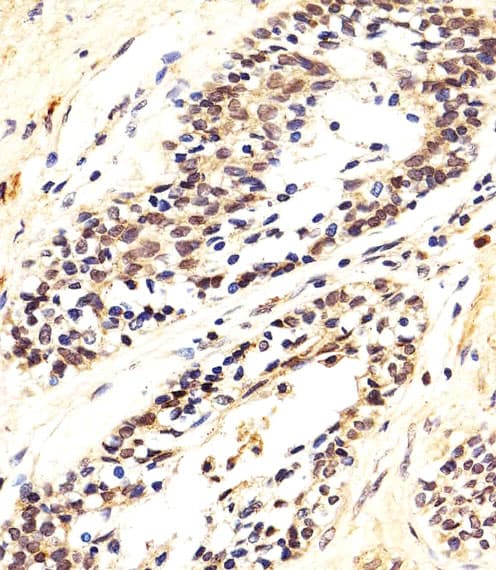 AKT1 Antibody (aa278-312)