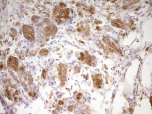 IHC-plus™ LGALS9 / Galectin 9 Antibody (clone 2A4)