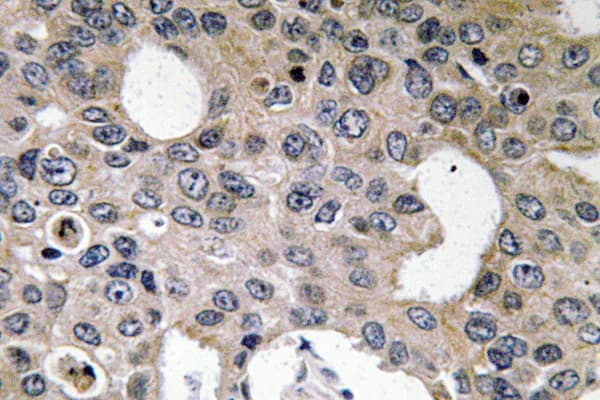 Polyclonal Rabbit anti-Human IL4R / CD124 Antibody (aa205-254, IHC)