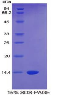 Human CTGF Protein (Recombinant His)