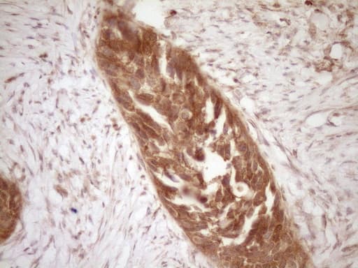 BCL2 / Bcl-2 Antibody (clone OTI9D3)