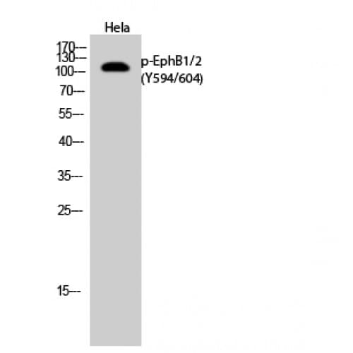 Polyclonal Rabbit anti-Human EPH Receptor B1+B2 Antibody (530-610 aa, IF, WB)