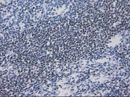 MEF2C Antibody (clone OTI2D2)