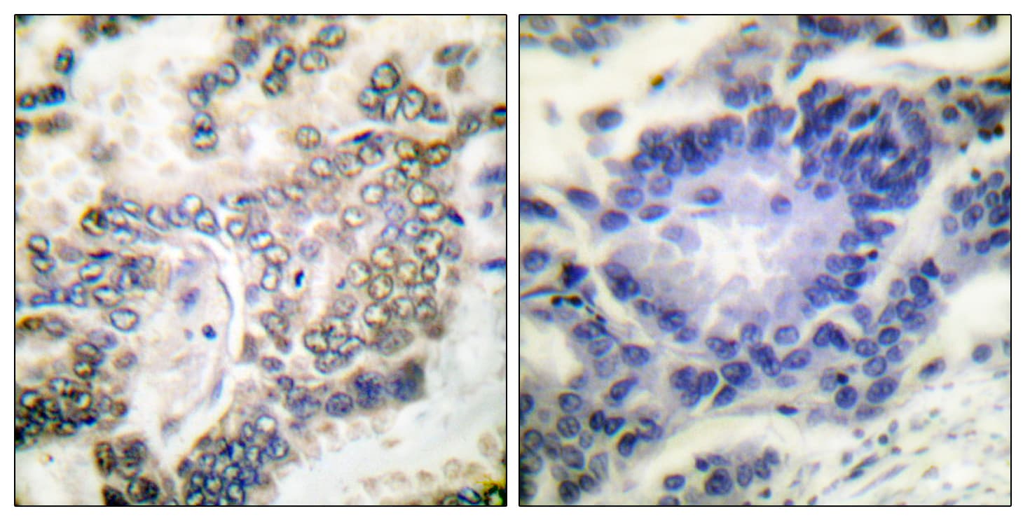 Polyclonal Rabbit anti-Human C/EBP Alpha / CEBPA Antibody (aa6-55, IHC, WB)