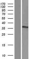 ZNF705G Protein (Over-Expression Lysate Myc-DDK (Flag))