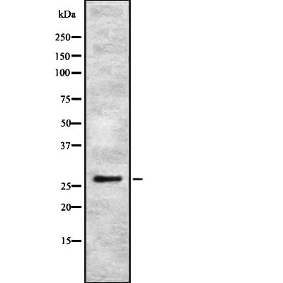 IGFBP4 Antibody