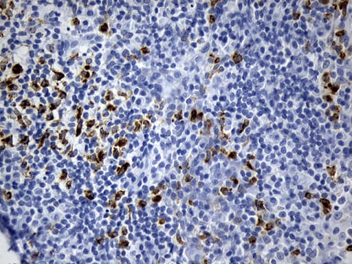 CTLA4 / CD152 Antibody (clone OTI1G10, Carrier-free)