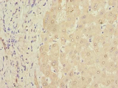PQLC3 Antibody