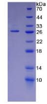 Mouse LAMA5 / Laminin Alpha 5 Protein (Recombinant His)