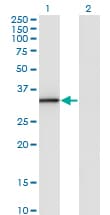 ANXA3 / Annexin A3 Antibody (clone 1E2)