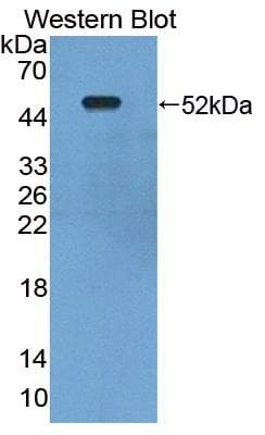 LDHD / Lactate Dehydrogenase D Antibody (aa62-265)