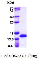 Human CSTA / Cystatin A Protein (Recombinant His)