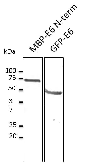 HPV11 E6 Antibody (N-Terminus)