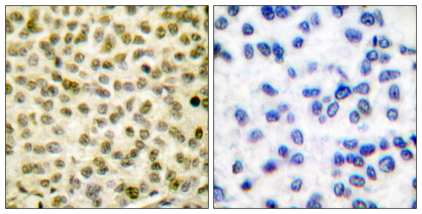 MYC / c-Myc Antibody (phospho-Ser62)