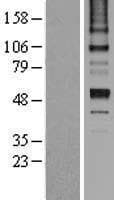 Human Antithrombin-III Protein (Over-Expression Lysate Myc-DDK (Flag))