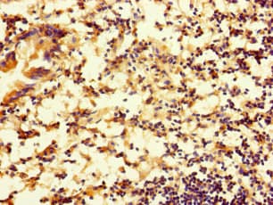 RTN4IP1 / NIMP Antibody