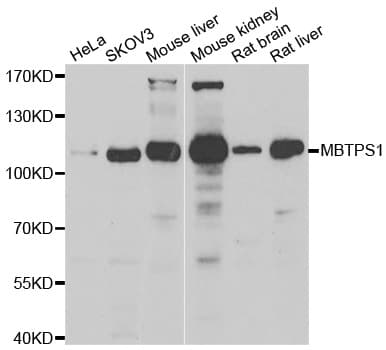 IHC-plus™ Polyclonal Rabbit anti-Human MBTPS1 / S1P Antibody (IHC, WB)