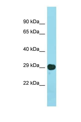 LSM14B Antibody (N-Terminus)