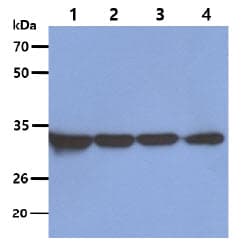 OTUB1 / OTU1 Antibody (clone AT17E10)