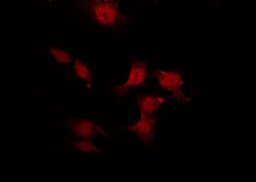 NOS3 / eNOS Antibody (phospho-Ser1177)