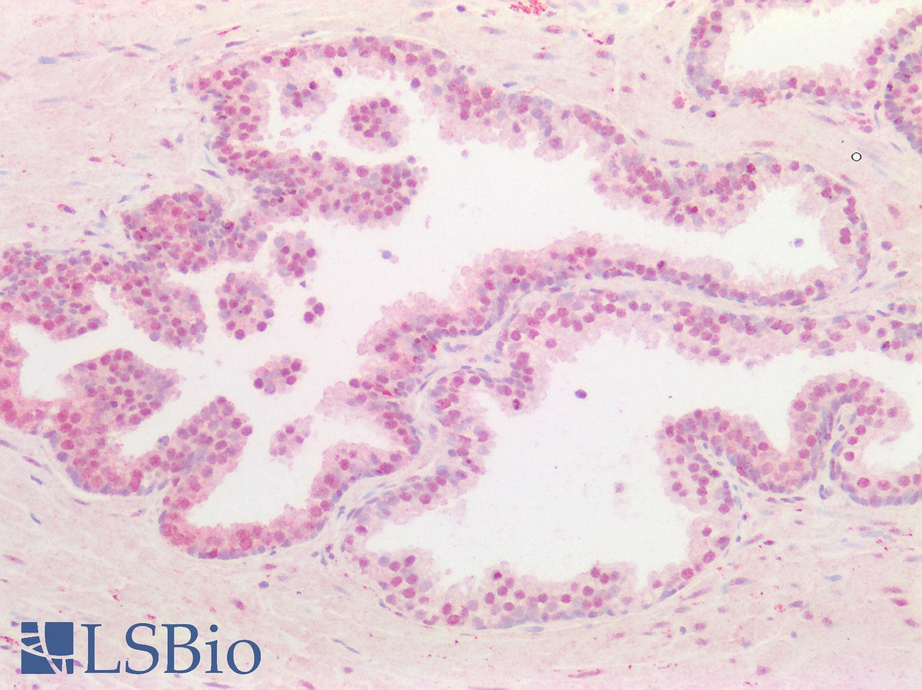 PathPlus™ Requiem / DPF2 Antibody