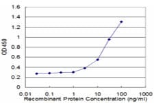 Monoclonal Mouse anti-Human MAP3K7 / TAK1 Antibody (clone 4E1-1A5, WB)