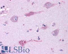 PathPlus™ GRM3 / MGLUR3 Antibody (N-Terminus)